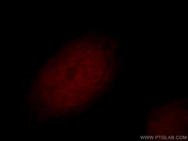 RFWD3 Antibody in Immunocytochemistry (ICC/IF)