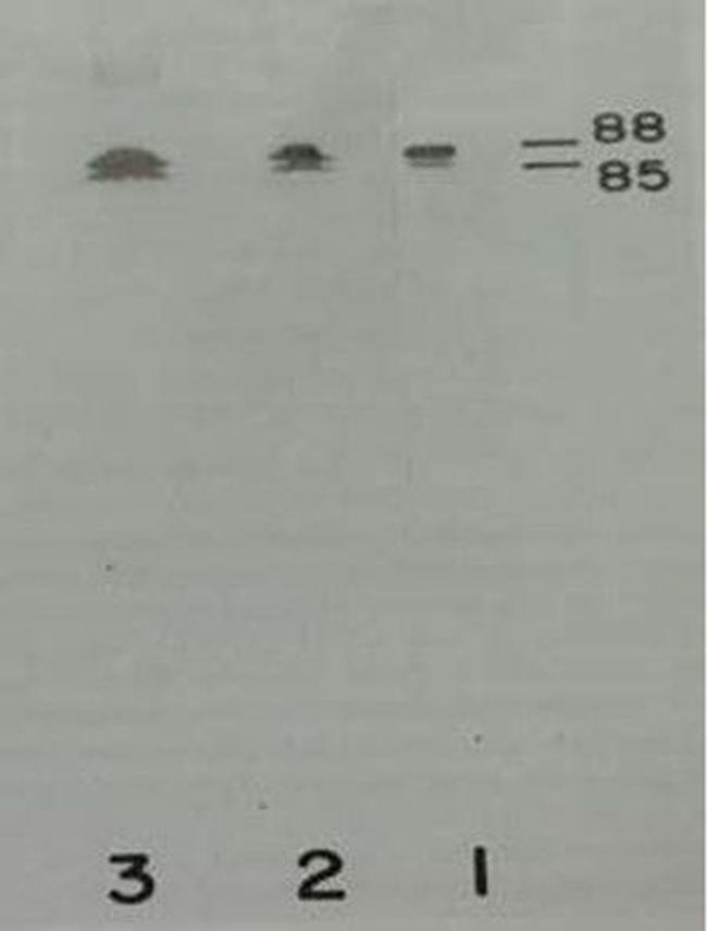 Prekallikrein Heavy Chain Antibody in Western Blot (WB)