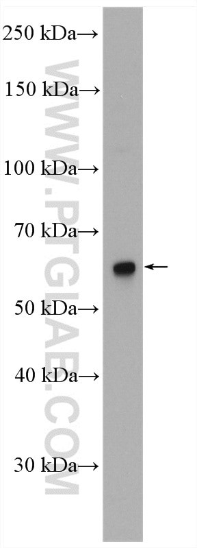 NUPL1 Antibody in Western Blot (WB)