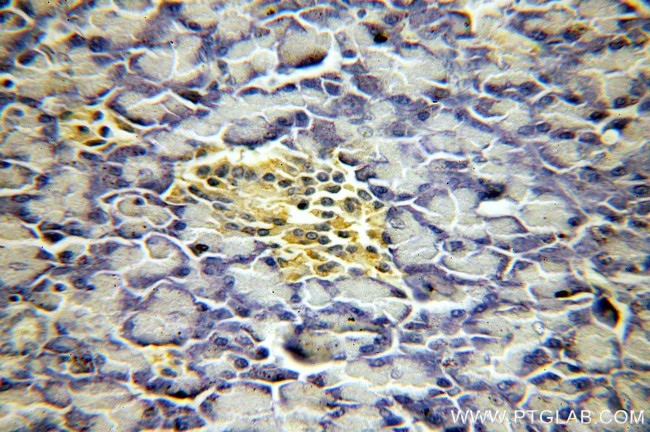 CHCHD7 Antibody in Immunohistochemistry (Paraffin) (IHC (P))