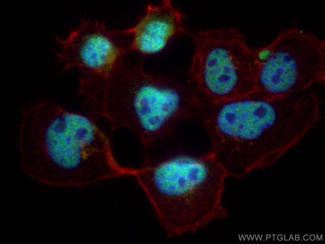 KDM3B Antibody in Immunocytochemistry (ICC/IF)