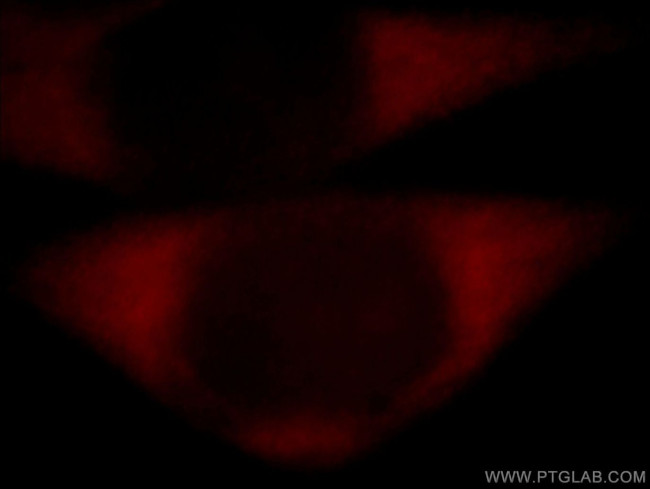 BZW1 Antibody in Immunocytochemistry (ICC/IF)