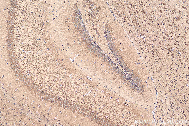 TMEM175 Antibody in Immunohistochemistry (Paraffin) (IHC (P))