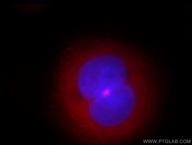 CEP72 Antibody in Immunocytochemistry (ICC/IF)