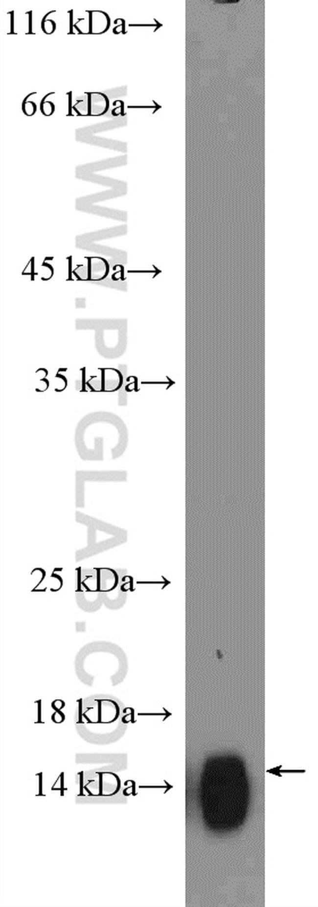 CST2 Antibody in Western Blot (WB)