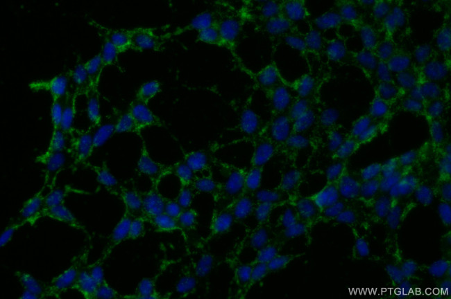 CELSR2 Antibody in Immunocytochemistry (ICC/IF)