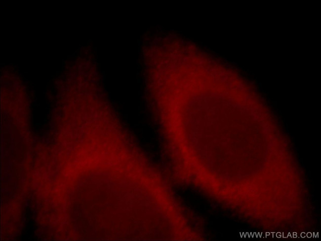 NMDAR2A Antibody in Immunocytochemistry (ICC/IF)