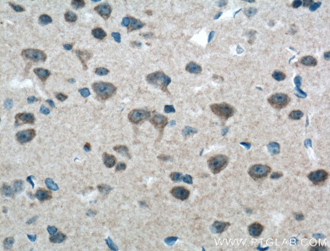 mGluR1 Antibody in Immunohistochemistry (Paraffin) (IHC (P))