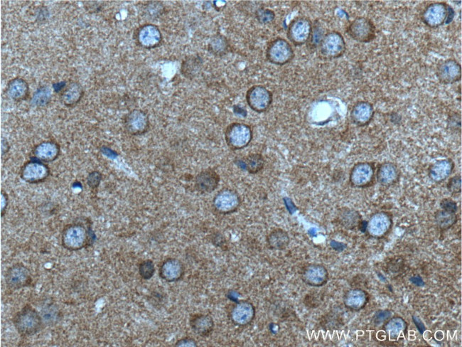 mGluR2 Antibody in Immunohistochemistry (Paraffin) (IHC (P))