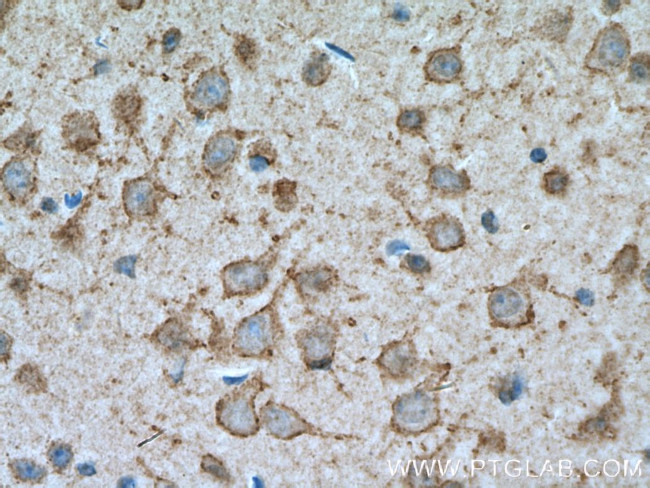 KCNB1 Antibody in Immunohistochemistry (Paraffin) (IHC (P))