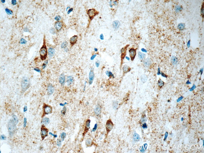 Kir2.1 Antibody in Immunohistochemistry (Paraffin) (IHC (P))