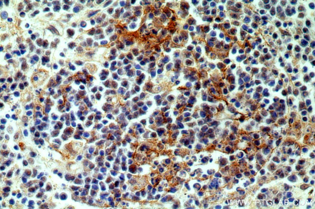 NKTR Antibody in Immunohistochemistry (Paraffin) (IHC (P))
