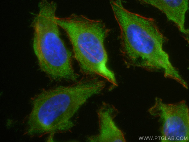 PAK2 Antibody in Immunocytochemistry (ICC/IF)
