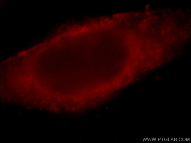LDHB Antibody in Immunocytochemistry (ICC/IF)