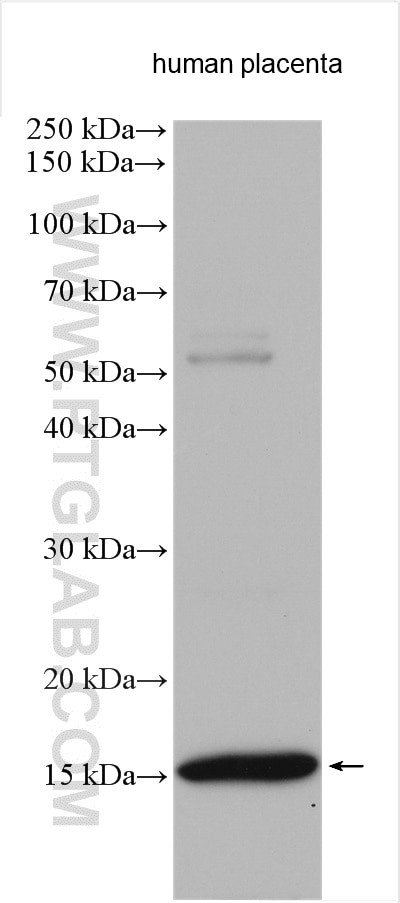 HBG1 Antibody in Western Blot (WB)