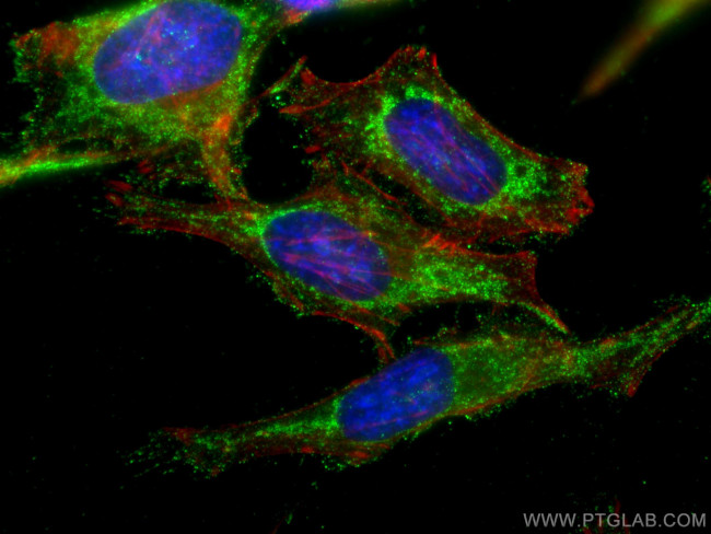 TGF-beta 2 Antibody in Immunocytochemistry (ICC/IF)