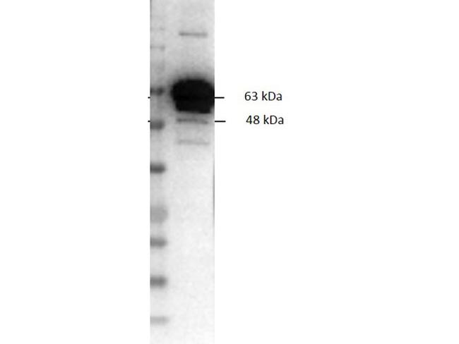 Pyruvate Kinase Antibody in Western Blot (WB)