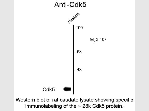 Cdk5 Antibody in Western Blot (WB)