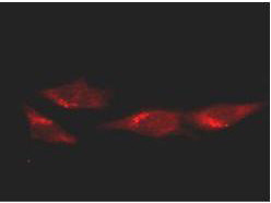 p53 Antibody in Immunocytochemistry (ICC/IF)
