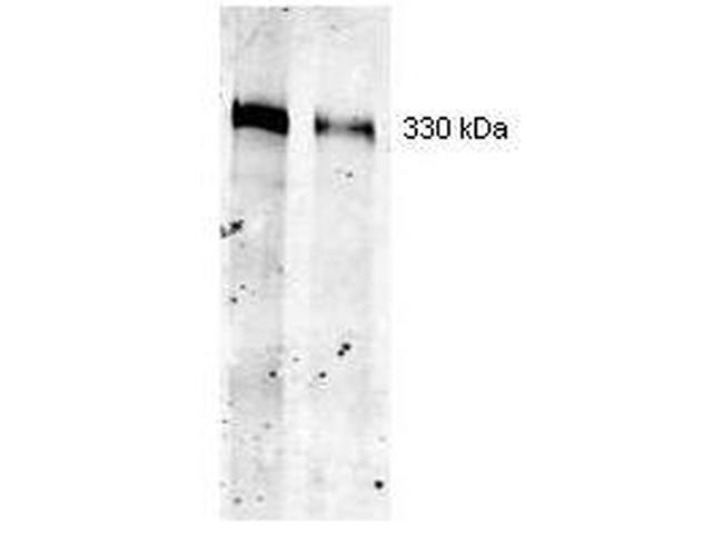 Thyroglobulin Antibody in Western Blot (WB)