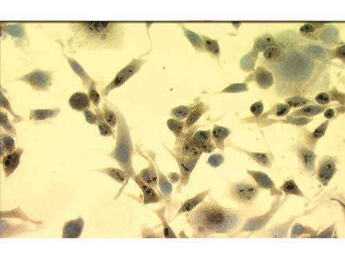 Hsp70 Antibody in Immunohistochemistry (Paraffin) (IHC (P))