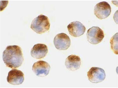 APAF1 Antibody in Immunocytochemistry (ICC/IF)