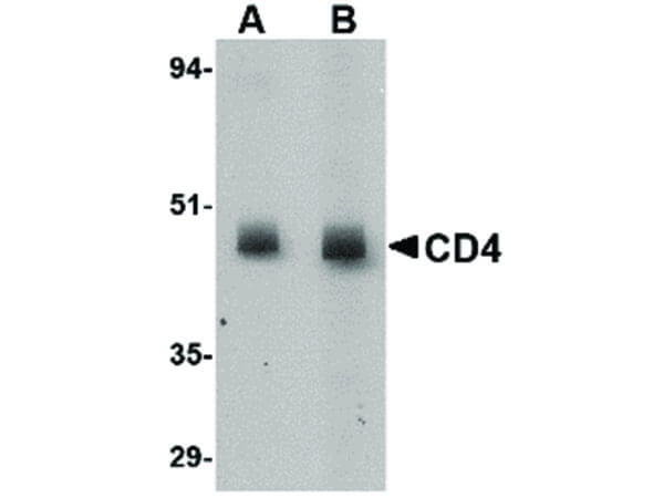 CD4 Antibody in Western Blot (WB)