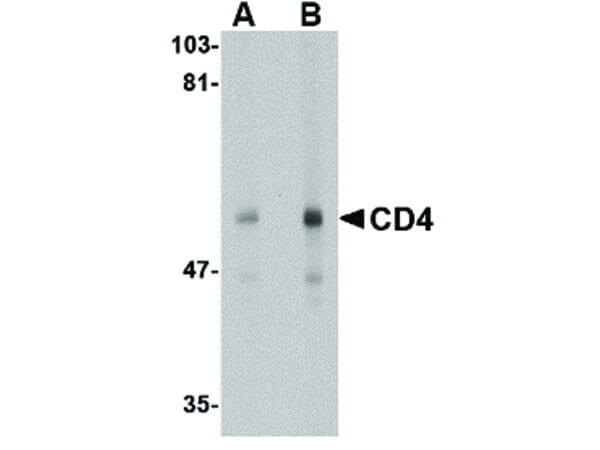 CD4 Antibody in Western Blot (WB)