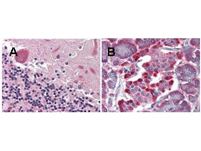 LGR4 Antibody in Immunohistochemistry (Paraffin) (IHC (P))
