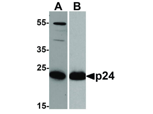 HIV-1 p24 Antibody in Western Blot (WB)