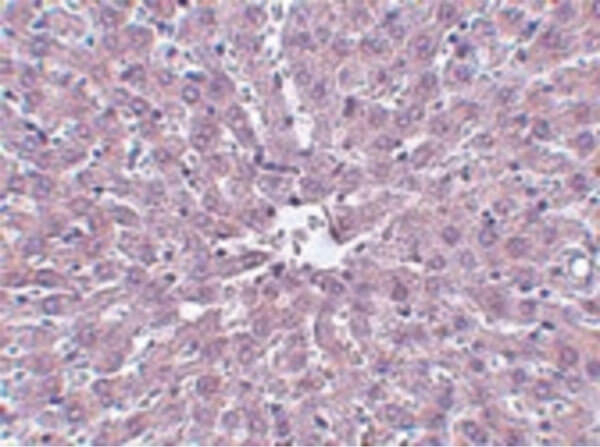 IRAK Antibody in Immunohistochemistry (Paraffin) (IHC (P))