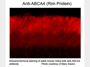 ABCA4 Rim Protein Antibody in Immunohistochemistry (Paraffin) (IHC (P))