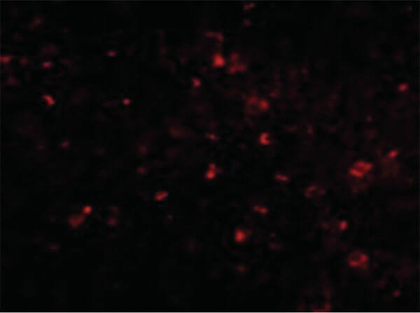 ORAI1 Antibody in Immunocytochemistry (ICC/IF)
