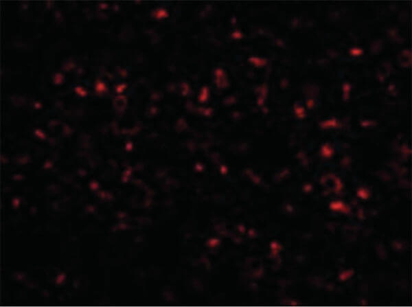 ORAI1 Antibody in Immunocytochemistry (ICC/IF)