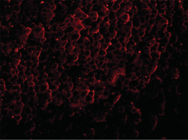 ORAI3 Antibody in Immunocytochemistry (ICC/IF)