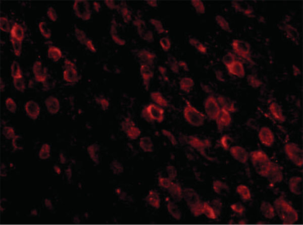 PD-1 Antibody in Immunocytochemistry (ICC/IF)