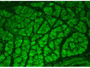 CaMKII Antibody in Immunohistochemistry (Paraffin) (IHC (P))