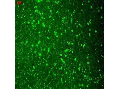 CAV1.2 Antibody in Immunocytochemistry (ICC/IF)