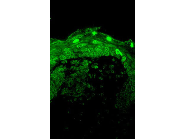Cav1.3 Antibody in Immunocytochemistry (ICC/IF)
