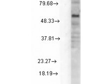 GABA-A Receptor delta Antibody in Western Blot (WB)