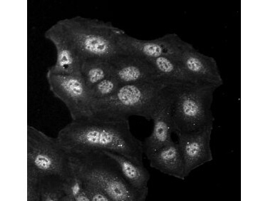 HDEL Antibody in Immunocytochemistry (ICC/IF)