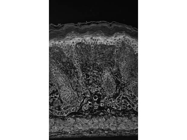 HIF-1-alpha Antibody in Immunohistochemistry (Paraffin) (IHC (P))
