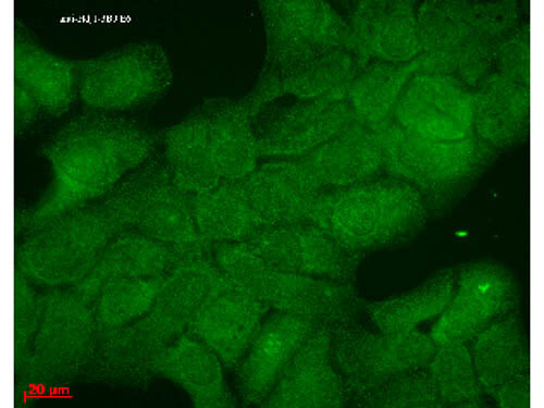 HSP40 (HDJ1) Antibody in Immunocytochemistry (ICC/IF)