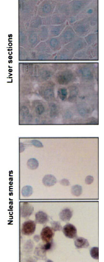 Hsp70/Hsc70 Antibody in Immunohistochemistry (Paraffin) (IHC (P))