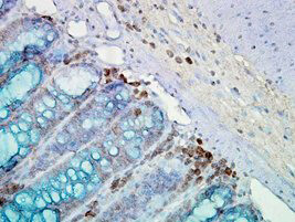HSP90 Antibody in Immunohistochemistry (Paraffin) (IHC (P))