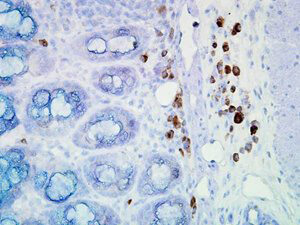 Hsp90 Antibody in Immunohistochemistry (Paraffin) (IHC (P))