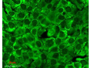 HSP90 total Antibody in Immunocytochemistry (ICC/IF)