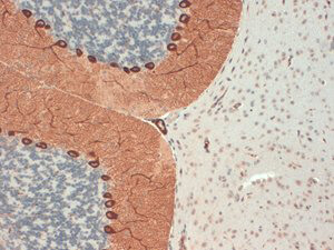 IP3 Receptor Antibody in Immunohistochemistry (IHC)