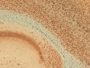 Kv2.1 Antibody in Immunohistochemistry (IHC)