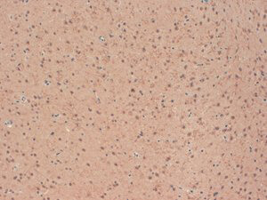 Kv2.1 Extracellular Antibody in Immunohistochemistry (IHC)